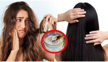 ಈ ಎಣ್ಣೆಯನ್ನ ಸ್ವಲ್ಪವೇ ಹಚ್ಚಿದ್ರೆ ಸಾಕು ತಕ್ಷಣ ಕೂದಲು ಉದುರುವಿಕೆ ನಿಲ್ಲುತ್ತೆ! ದಟ್ಟವಾಗಿ ಕೂದಲು ಬೆಳೆಯುತ್ತವೆ