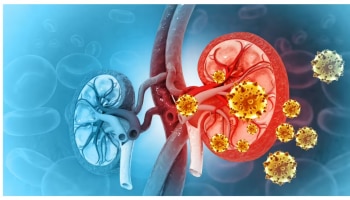 ಮಹಿಳೆಯರ ದೇಹದ ಈ ಭಾಗದಲ್ಲಿನ ಊತ... ಕಿಡ್ನಿ ಸಮಸ್ಯೆಯ ಮುಖ್ಯ ಲಕ್ಷಣ!