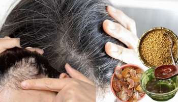 ಹೆಚ್ಚು ದುಬಾರಿಯಲ್ಲ... ಬೂದು ಕೂದಲಿಗೆ ಬ್ರೇಕ್‌ ಹಾಕಿ ಉದ್ದ ಕೂದಲು ಪಡೆಯಲು ಹೇರ್‌ ಆಯಿಲ್‌ನಲ್ಲಿ ಇವೆರಡನ್ನು ಬೆರೆಸಿ ಹಚ್ಚಿ 