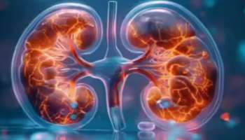 ಮದ್ಯಪಾನ ಮಾತ್ರವಲ್ಲ ಈ ಆಹಾರಗಳು ಕೂಡಾ ಕಿಡ್ನಿ ಆರೋಗ್ಯ ಕೆಡಿಸುತ್ತದೆ !