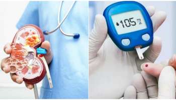 ಮಧುಮೇಹಿಗಳೇ ಹುಷಾರ್‌! ನಿಮ್ಮ ದೇಹದಲ್ಲಿ ಈ ಲಕ್ಷಣ ಕಾಣಿಸಿಕೊಂಡರೆ ನಿಮ್ಮ ಕಿಡ್ನಿ ಫೆಲ್ಯೂರ್‌ ಆಗಿದೆ ಅಂತ ಅರ್ಥ..!