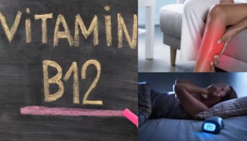 ದೇಹದಲ್ಲಿ ಈ ಲಕ್ಷಣಗಳು ಕಂಡುಬಂದ್ರೆ ವಿಟಮಿನ್ B12 ಕೊರತೆ ಇದೆ ಎಂದರ್ಥ...