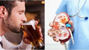 ಎಣ್ಣೆ ಹೊಡೆಯೋಕು 2 ಗಂಟೆಗೆ ಮುಂಚೆ ಜಸ್ಟ್‌ ಹೀಗೆ ಮಾಡಿ.! ಎಷ್ಟು ಕುಡಿದರೂ ಕಿಡ್ನಿಗೆ ಏನೂ ಆಗಲ್ಲ