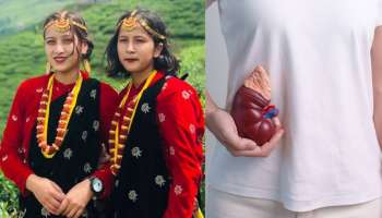 ಒಂದೇ ಕಿಡ್ನಿ ಮೇಲೆ ಜೀವನ ನಡೆಸುತ್ತಿರುವ ಜನರಿರುವ ವಿಚಿತ್ರ ಹಳ್ಳಿ ಯಾವುದು ಗೊತ್ತಾ? ಕಾರಣ ಕೇಳಿದ್ರೆ ಶಾಕ್‌ ಆಗ್ತೀರಾ..