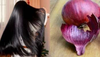 ಒಂದೇ ನಿಮಿಷದಲ್ಲಿ ಬಿಳಿಕೂದಲನ್ನು ಕಪ್ಪಾಗಿಸುತ್ತೆ ಈರುಳ್ಳಿ ಸಿಪ್ಪೆ! ಬಳಸುವ ವಿಧಾನ ಹೀಗಿರಲಿ..