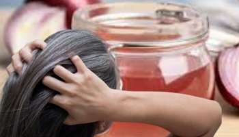 ಈರುಳ್ಳಿ ರಸದಲ್ಲಿ ಇವುಗಳನ್ನು ಬೆರೆಸಿ ಲೇಪಿಸಿದರೆ ಬೆಳ್ಳಗಿರುವ ಕೂದಲು ಕಪ್ಪಾಗೋದು ಗ್ಯಾರಂಟಿ!