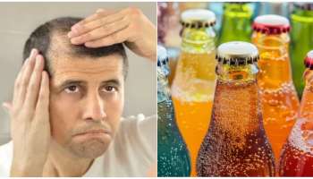 Hair loss : ಕೂಲ್ ಡ್ರಿಂಕ್ಸ್ ಕುಡಿಯುವುದರಿಂದ ಕೂದಲು ಉದುರುತ್ತದೆಯೇ? ಸತ್ಯ ತಿಳಿದರೆ ನಿಮಗೆ ಶಾಕ್ ಆಗುತ್ತೆ