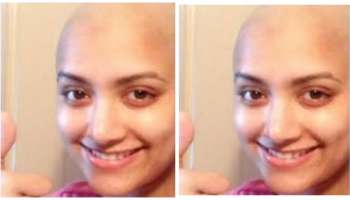 ಕೂದಲು ಉದುರಿ, ತಲೆ ಬೋಳಾಗಿ ಗುರುತು ಸಿಗದಂತೆ ಬದಲಾದ ಕನ್ನಡ ನಟಿ..! ಏನಾಯ್ತು?