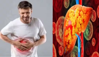 ಈ ಸೂಪರ್‌ಫುಡ್‌ ಸೇವಿಸಿದ್ರೆ ಫ್ಯಾಟಿ ಲಿವರ್‌ ಸಮಸ್ಯೆಯಿಂದ ಸಿಗುತ್ತೆ ಮುಕ್ತಿ...