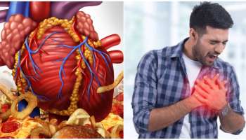 ಈ 5 ಆಹಾರಗಳು ತುಂಬಾ ಅಪಾಯಕಾರಿ..! ತಿಂದರೆ ಹೃದಯಾಘಾತ ಖಚಿತ.. ಇದು ವೈದ್ಯರ ಎಚ್ಚರಿಕೆ  