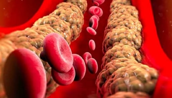 ಪ್ರತಿದಿನ ಈ ತರಕಾರಿ ತಿಂದ್ರೆ ಹೊಟ್ಟೆಯಲ್ಲಿರೋ ಬೊಜ್ಜು ಮೇಣದಂತೆ ಕರಗುತ್ತೆ...