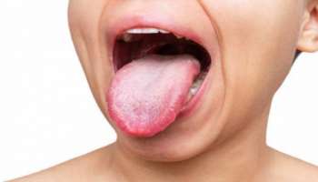 Tongue Colour: ನಾಲಿಗೆ ಬಣ್ಣದಲ್ಲಿ ಅಡಗಿದೆ ನಿಮ್ಮ ಆರೋಗ್ಯದ ಗುಟ್ಟು! ಹೀಗೆ ತಿಳಿಯಿರಿ 