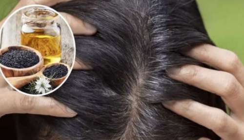 ಎಳ್ಳೆಣ್ಣೆಯನ್ನು ಇವುಗಳೊಂದಿಗೆ ಬಳಸಿದರೆ ಬಿಳಿ ಕೂದಲು ನ್ಯಾಚುರಲ್ ಆಗಿಯೇ ಕಪ್ಪಾಗುತ್ತೆ 