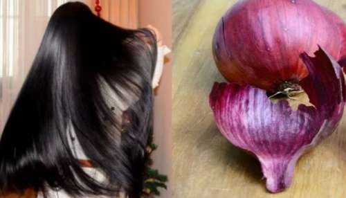 ಒಂದೇ ನಿಮಿಷದಲ್ಲಿ ಬಿಳಿಕೂದಲನ್ನು ಕಪ್ಪಾಗಿಸುತ್ತೆ ಈರುಳ್ಳಿ ಸಿಪ್ಪೆ! ಬಳಸುವ ವಿಧಾನ ಹೀಗಿರಲಿ..