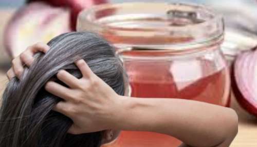 ಈರುಳ್ಳಿ ರಸದಲ್ಲಿ ಇವುಗಳನ್ನು ಬೆರೆಸಿ ಲೇಪಿಸಿದರೆ ಬೆಳ್ಳಗಿರುವ ಕೂದಲು ಕಪ್ಪಾಗೋದು ಗ್ಯಾರಂಟಿ!