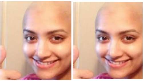 ಕೂದಲು ಉದುರಿ, ತಲೆ ಬೋಳಾಗಿ ಗುರುತು ಸಿಗದಂತೆ ಬದಲಾದ ಕನ್ನಡ ನಟಿ..! ಏನಾಯ್ತು?