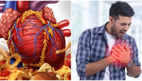 ಈ 5 ಆಹಾರಗಳು ತುಂಬಾ ಅಪಾಯಕಾರಿ..! ತಿಂದರೆ ಹೃದಯಾಘಾತ ಖಚಿತ.. ಇದು ವೈದ್ಯರ ಎಚ್ಚರಿಕೆ  