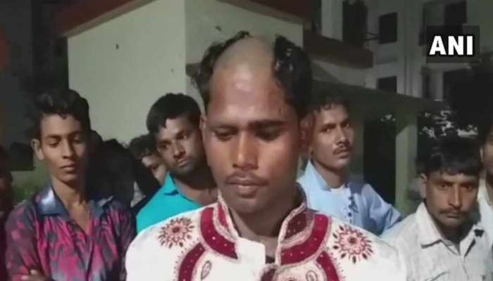 ವರದಕ್ಷಿಣೆಗಾಗಿ ವಿವಾಹ ನಿರಾಕರಿಸಿದ ವರನಿಗೆ ವಧುವಿನ ಕಡೆಯವರು ಏನ್ ಮಾಡಿದ್ರು ಗೊತ್ತಾ? ವರದಕ್ಷಿಣೆಗಾಗಿ ವಿವಾಹ ನಿರಾಕರಿಸಿದ ವರನಿಗೆ ವಧುವಿನ ಕಡೆಯವರು ಏನ್ ಮಾಡಿದ್ರು ಗೊತ್ತಾ?