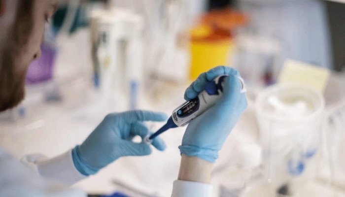 BIG NEWS: Covid 19 Vaccine ಅಭಿವೃದ್ಧಿಗಾಗಿ ಕೊರೊನಾ ವೈರಸ್ ಪ್ರೋಟೀನ್ ಪುನರ್ರಚಿಸಿದ ವಿಜ್ಞಾನಿಗಳು BIG NEWS: Covid 19 Vaccine ಅಭಿವೃದ್ಧಿಗಾಗಿ ಕೊರೊನಾ ವೈರಸ್ ಪ್ರೋಟೀನ್ ಪುನರ್ರಚಿಸಿದ ವಿಜ್ಞಾನಿಗಳು