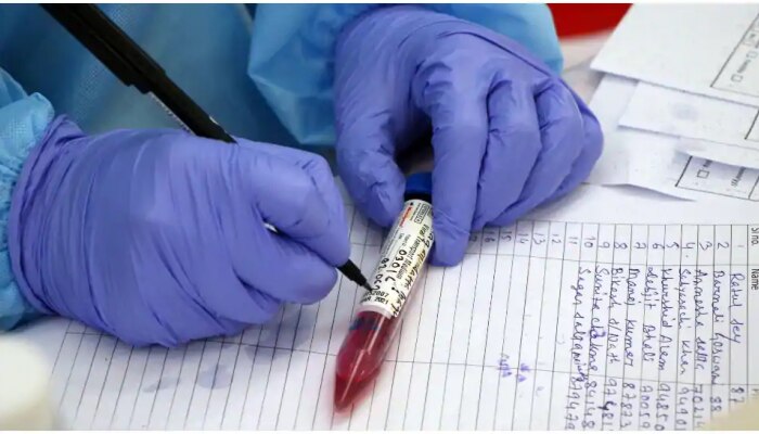 ಇನ್ಮುಂದೆ ಕೇವಲ 36 ನಿಮಿಷಗಳಲ್ಲಿ ಹೊರಬೀಳಲಿದೆ Corona Test Report ಇನ್ಮುಂದೆ ಕೇವಲ 36 ನಿಮಿಷಗಳಲ್ಲಿ ಹೊರಬೀಳಲಿದೆ Corona Test Report