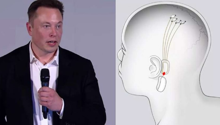 Elon Musk ನೂತನ ಯೋಜನೆ, ಮೆದುಳು ನಿಯಂತ್ರಿಸುವ ಚಿಪ್ ನಲ್ಲಿ ನೆನಪುಗಳ Back-UP ಪಡೆಯಬಹುದಂತೆ 