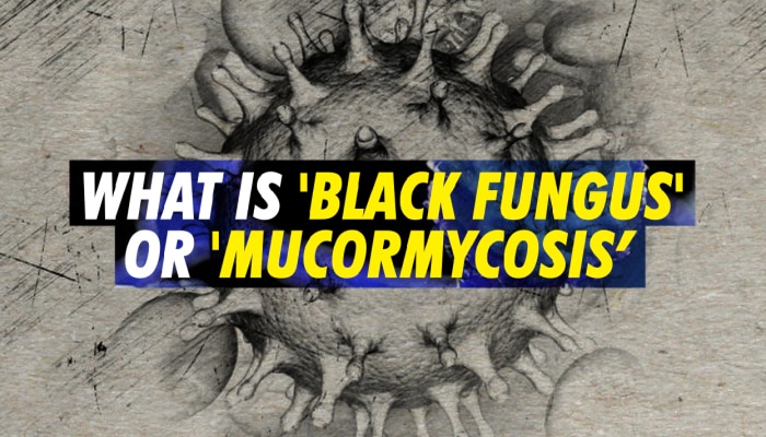 Mucormycosis Symptoms And Treatment: Black Fungus ಕಾಯಿಲೆ ಹೇಗೆ ಬರುತ್ತದೆ? ಹೇಗೆ ರಕ್ಷಿಸಿಕೊಳ್ಳಬೇಕು? ಕೇಂದ್ರ ಆರೋಗ್ಯ ಸಚಿವರು ಹೇಳಿದ್ದೇನು? title=