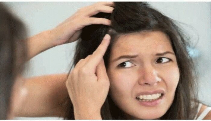 Hair Care Tips: ಈ ತರಕಾರಿಯ ಸಿಪ್ಪೆಯಿಂದ ದೂರವಾಗುತ್ತೆ ನಿಮ್ಮ ಬಿಳಿಕೂದಲಿನ ಸಮಸ್ಯೆ
