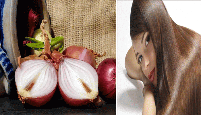 Onion Oil Benefits For Hairs: ಕೂದಲಿಗೆ ಈರುಳ್ಳಿ ಎಣ್ಣೆಯನ್ನು ಬಳಸಿ ಈ ರೀತಿ ಪ್ರಯೋಜನ ಪಡೆಯಿರಿ
