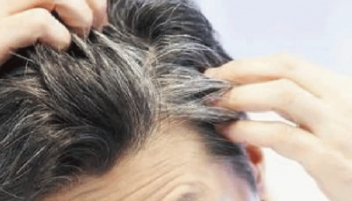 Hair Care Tips: Hair turning white prematurely? Do not panic, follow these  methods | Hair Care Tips: ಅಕಾಲಿಕ ಬಿಳಿ ಕೂದಲಿನ ಸಮಸ್ಯೆ ನಿವಾರಣೆಗೆ ಈ ಟಿಪ್ಸ್  ಅನುಸರಿಸಿ Lifestyle News in Kannada