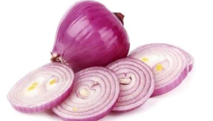 Onion Health Benefits : ಈ ಕಾರಣಗಳಿಗಾಗಿ ನಿಮ್ಮ ಆಹಾರದಲ್ಲಿ ಭರಪೂರವಾಗಿರಲಿ ಈರುಳ್ಳಿ  