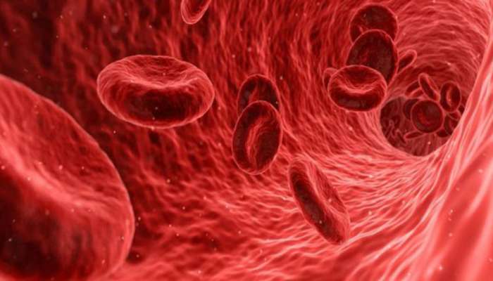 How To Increase Hemoglobin: ದೇಹದಲ್ಲಿ ಹಿಮೊಗ್ಲೋಬಿನ್ ಹೆಚ್ಚಿಸಲು ಸೇವಿಸಿ ಈ ಆಹಾರ 
