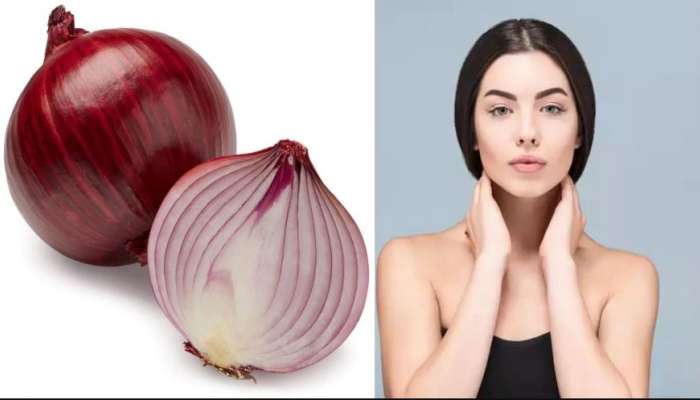 Onion Benefits : ಮುಖದ ಮೇಲಿನ ಕಲೆ, ಹೊಳಪಿಗಾಗಿ ಬಳಸಿ 1 ಈರುಳ್ಳಿ : ಇದನ್ನ ಬಳಸುವ ಸರಿಯಾದ ಮಾರ್ಗ ಇಲ್ಲಿದೆ
