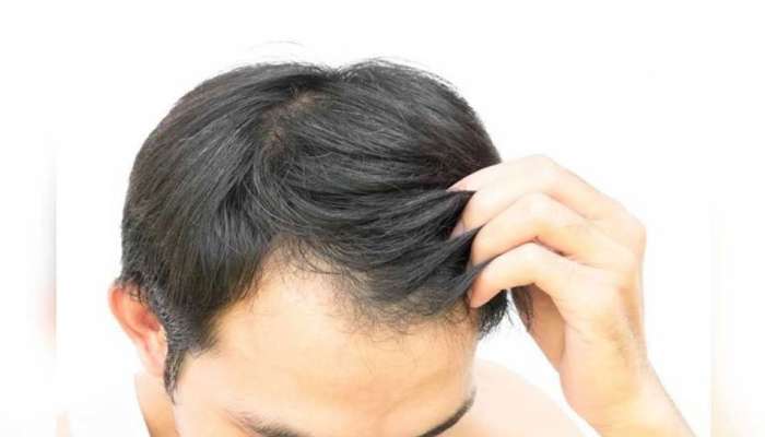 Hair Care Tips: How many times a week should men apply hair oil? |Hair Care Tips: ಪುರುಷರು ವಾರದಲ್ಲಿ ಎಷ್ಟು ಸಲ ಕೂದಲಿಗೆ ಎಣ್ಣೆ ಹಚ್ಚಬೇಕು? Lifestyle News in Kannada Hair Care Tips: How many times a week should men apply hair oil? |Hair Care Tips: ಪುರುಷರು ವಾರದಲ್ಲಿ ಎಷ್ಟು ಸಲ ಕೂದಲಿಗೆ ಎಣ್ಣೆ ಹಚ್ಚಬೇಕು? Lifestyle News in Kannada