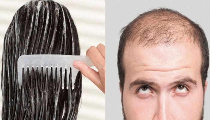 Hair Care Tips: ಹೇರ್ ಕಂಡೀಷನರ್ ಹಚ್ಚುವುದರಿಂದ ಕೂದಲು ಉದುರುತ್ತದೆಯೇ? title=