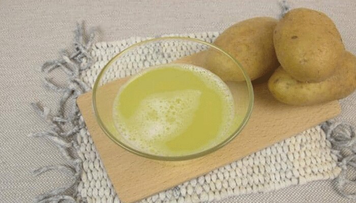 Potato Juice: ಕೊಲೆಸ್ಟ್ರಾಲ್ ಕಡಿಮೆ ಮಾಡಲು ಆಲೂಗಡ್ಡೆ ರಸವನ್ನು ಈ ರೀತಿ ತಯಾರಿಸಿ 