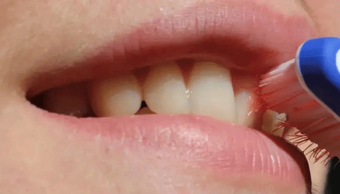 Oral Health:ಪ್ರತಿದಿನ ಹಲ್ಲುಜ್ಜುವ ಅಭ್ಯಾಸ ಈ ಗಂಭೀರ ಕಾಯಿಲೆಗಳಿಂದ ನಿಮ್ಮನ್ನು ರಕ್ಷಿಸುತ್ತದೆ  