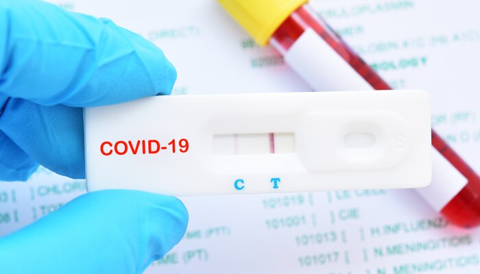 Coronavirus In Karnataka: ಬೆಂಗಳೂರಿನ ನರ್ಸಿಂಗ್ ಕಾಲೇಜಿನ 12 ವಿದ್ಯಾರ್ಥಿಗಳಿಗೆ ಕೊರೊನಾ ಸೋಂಕು, 11 ವಿದ್ಯಾರ್ಥಿಗಳು ಎರಡೂ ಲಸಿಕೆ ಹಾಕಿಸಿಕೊಂಡಿದ್ದಾರೆ