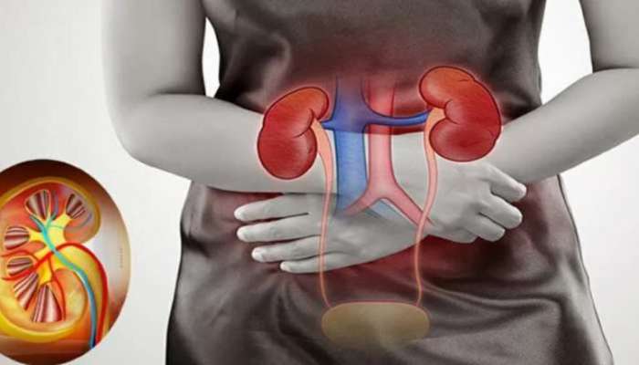 Kidney Disease Warning Signs : ಕಿಡ್ನಿ ವೈಫಲ್ಯಕ್ಕೂ ಮೊದಲು ದೇಹವು ನೀಡುತ್ತದೆ ಈ 5 ಸಂಕೇತಗಳನ್ನು!