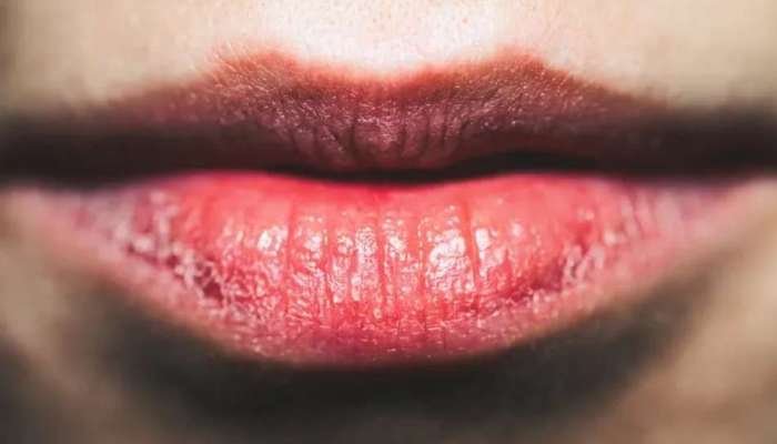 Lips Beauty Tips: ತುಟಿಗಳ ಅಂದ ಹೆಚ್ಚಿಸಲು ಮನೆಯಲ್ಲೇ ಇದೆ ಮದ್ದು  title=