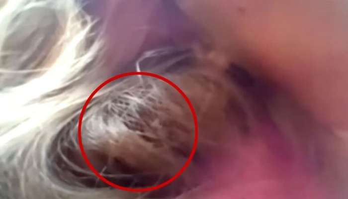 Bird Nests in Woman Hair: ಕೂದಲಲ್ಲಿ ಗೂಡುಕಟ್ಟಿದ ಹಕ್ಕಿ, ಮಹಿಳೆಯ ಸ್ಥಿತಿ ಏನಾಯ್ತು ಗೊತ್ತಾ..! title=