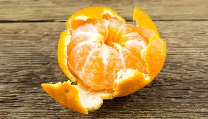 Orange Peel Benefits: ಕಿತ್ತಳೆ ಸಿಪ್ಪೆ ಎಸೆಯುವ ಮುನ್ನ ಅದರ ಈ ಐದು ಪ್ರಯೋಜನಗಳ ಬಗ್ಗೆ ತಿಳಿಯಿರಿ 