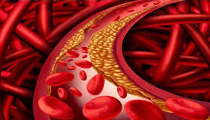Cholesterol Control Home Remedies: ಕೊಲೆಸ್ಟ್ರಾಲ್ ನಿಯಂತ್ರಣಕ್ಕೆ ರಾಮಬಾಣ ಉಪಾಯ