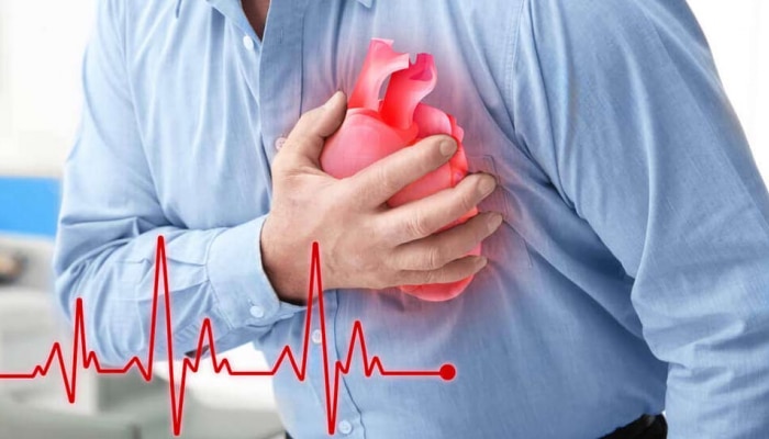 Heart Attack Risk: ಈ ಜನರಿಗೆ ಹೃದಯಾಘಾತದ ಅಪಾಯ ಹೆಚ್ಚು, ಈ ಕ್ರಮಗಳನ್ನು ಅನುಸರಿಸಿ