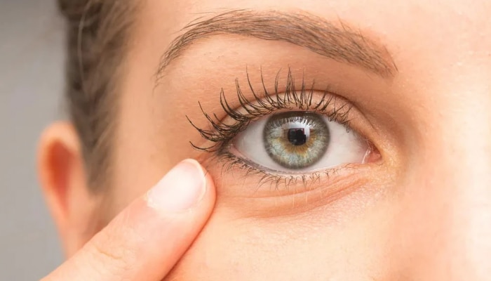Eye Care Tips: ಕಣ್ಣುಕುಳಿ ಸಮಸ್ಯೆಯಿಂದ ಮುಕ್ತಿಪಡೆಯಲು ಈ ಸಲಹೆಗಳನ್ನು ಅನುಸರಿಸಿ
