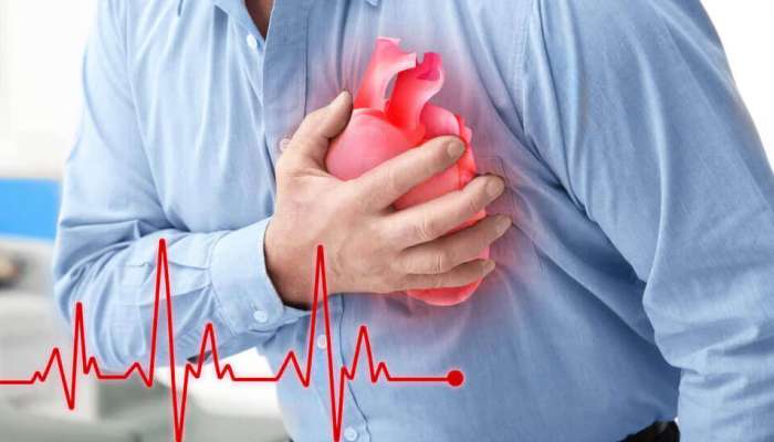 Type of Heart Disease:  ಹೃದಯ ಸ್ತಂಭನ-ಹೃದಯಾಘಾತದ ನಡುವಿನ ವ್ಯತ್ಯಾಸವೇನು?