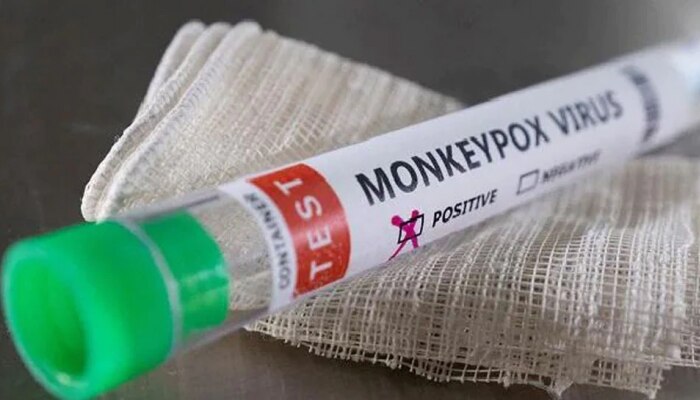 Monkeypox Test Kit Launched: now monkeypox will be tested rtpcr kit launched results will be available in just 50 minutes Monkeypox: ಮಂಕಿಪಾಕ್ಸ್ ಪತ್ತೆಗೆ ಬಿಡುಗಡೆಯಾದ RT-PCR ಕಿಟ್, ಕೇವಲ 50 ನಿಮಿಷಗಳಲ್ಲಿಯೇ ...