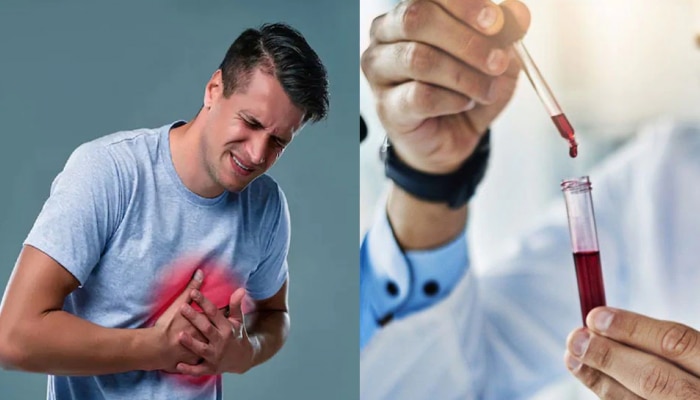Heart Attack: ಈ ಒಂದೇ ಒಂದು ಟೆಸ್ಟ್ ನಿಂದ ಹೃದ್ರೋಗಗಳನ್ನು ಮೊದಲೇ ಪತ್ತೆಹಚ್ಚಬಹುದು