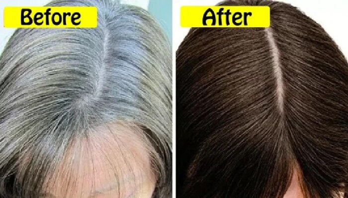 White Hair Problem: Effective Home Remedies For White Hair|White Hair: ಬಿಳಿ ಕೂದಲ ಸಮಸ್ಯೆಗೆ ಇಲ್ಲಿದೆ ಸುಲಭ ಪರಿಹಾರ Lifestyle News in Kannada White Hair Problem: Effective Home Remedies For White Hair|White Hair: ಬಿಳಿ ಕೂದಲ ಸಮಸ್ಯೆಗೆ ಇಲ್ಲಿದೆ ಸುಲಭ ಪರಿಹಾರ Lifestyle News in Kannada