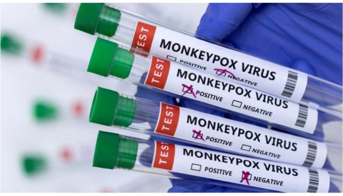 Monkeypox Symptoms: ಇವೇ ನೋಡಿ ಮಂಕಿಪಾಕ್ಸ್‌ನ ಹೊಚ್ಚ ಹೊಸ ಲಕ್ಷಣಗಳು, ವಿಜ್ಞಾನಿಗಳ ಎಚ್ಚರಿಕೆ !