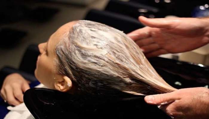 Hair Care Tips: ಕೂದಲಿನ ಈ 5 ಸಮಸ್ಯೆಗಳಿಗೆ ಮುಕ್ತಿ ನೀಡುತ್ತೆ ಆಮ್ಲಾ ಪೌಡರ್, ಮೊಟ್ಟೆ ಹೇರ್ ಪ್ಯಾಕ್.! 